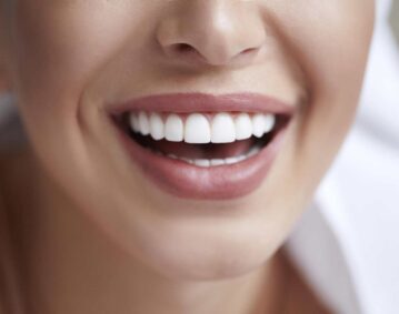 estética dental Clinica dental Marbán, Valladolid.