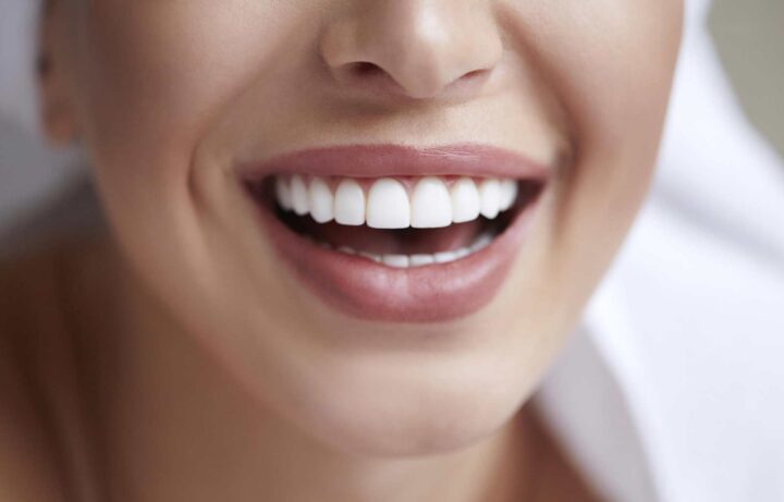 estética dental Clinica dental Marbán, Valladolid.